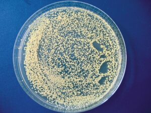 FreiLacke ETL - Bakterien erfolgreich die Grundlage entziehen